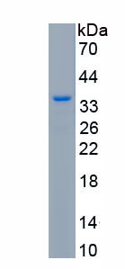 Recombinant Ki-67 Protein (Ki-67)