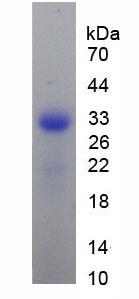 Recombinant Receptor Activator Of Nuclear Factor Kappa B (RANk)