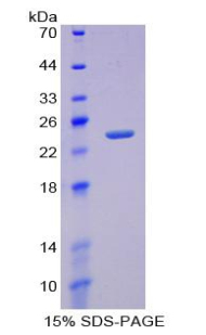 Recombinant Receptor Activator Of Nuclear Factor Kappa B (RANk)