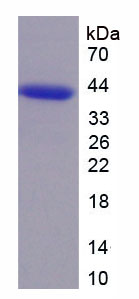 Recombinant Cyclin Dependent Kinase 6 (CDK6)