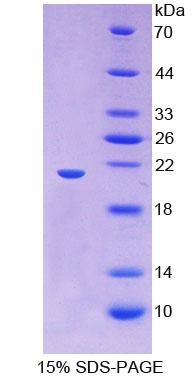 Recombinant Hyaluronan Mediated Motility Receptor (HMMR)