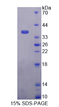 Recombinant Dual Oxidase 2 (DUOX2)