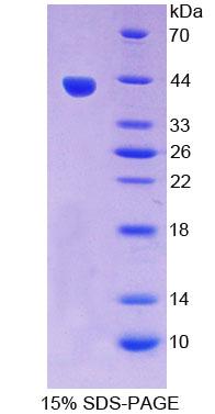 Recombinant VEGF Co Regulated Chemokine 1 (VCC1)