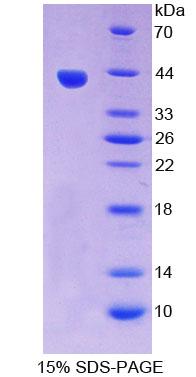 Recombinant VEGF Co Regulated Chemokine 1 (VCC1)