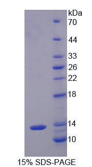 Recombinant Interferon Inducible T-Cell Alpha Chemoattractant (ITaC)