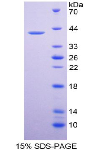 Recombinant Interferon Inducible T-Cell Alpha Chemoattractant (ITaC)