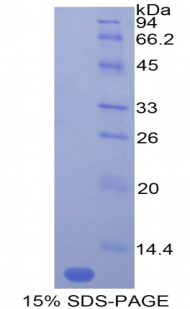 Recombinant Monocyte Chemotactic Protein 5 (MCP5)