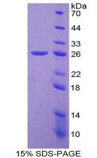 Recombinant Laminin Beta 3 (LAMb3)