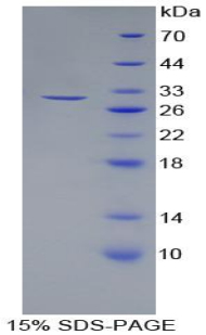 Recombinant Laminin Beta 3 (LAMb3)