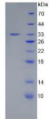 Recombinant Laminin Gamma 1 (LAMC1)