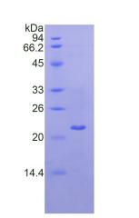 Recombinant Laminin Gamma 1 (LAMC1)