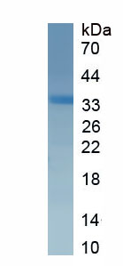 Recombinant Laminin Gamma 1 (LAMC1)