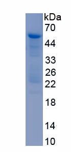 Recombinant Laminin Gamma 2 (LAMC2)