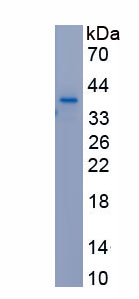 Recombinant Laminin Gamma 2 (LAMC2)