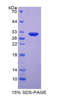 Recombinant Integrin Beta 5 (ITGb5)