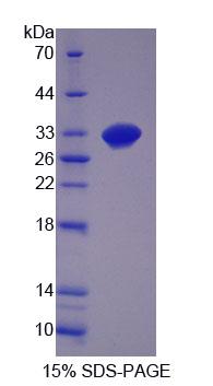 Recombinant Growth Differentiation Factor 11 (GDF11)