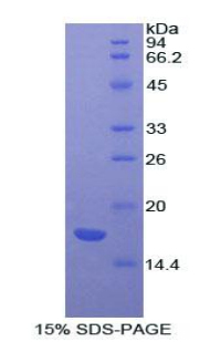 Recombinant Activin A Receptor Type II A (ACVR2A)