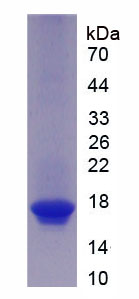 Recombinant Activin A Receptor Type II B (ACVR2B)