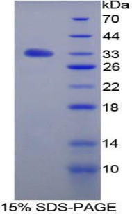 Recombinant Transforming Growth Factor Beta Receptor III (TGFbR3)