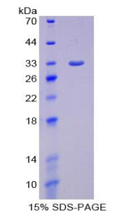 Recombinant SMAD family member 6 (SMAD6)