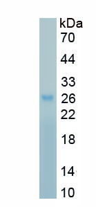 Recombinant Mothers Against Decapentaplegic Homolog 2 (Smad2)