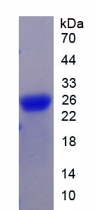 Recombinant Gremlin 1 (GREM1)