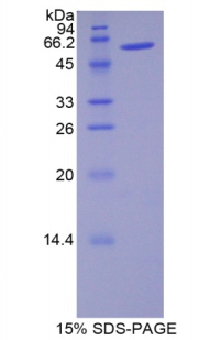 Recombinant Noggin (NOG)