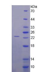 Recombinant Collagen Type XVI (COL16)