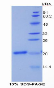 Recombinant Collagen Type XV (COL15)