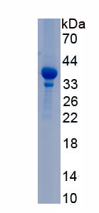 Recombinant Collagen Type XI Alpha 2 (COL11a2)