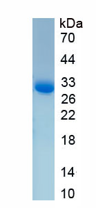 Recombinant Collagen Type IV Alpha 5 (COL4a5)