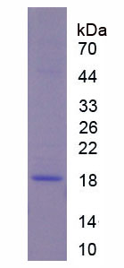 Recombinant Collagen Type VIII Alpha 1 (COL8a1)