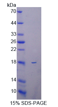 Recombinant Collagen Type X (COL10)