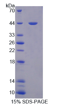 Recombinant Persephin (PSPN)