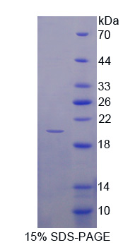 Recombinant Glia Maturation Factor Beta (GMFb)