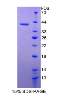 Recombinant Left/Right Determination Factor 1 (LEFTY1)