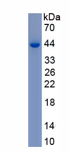 Recombinant Brevican (BCAN)