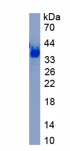 Recombinant Neurocan (NCAN)