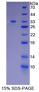 Recombinant V-Erb B2 Erythroblastic Leukemia Viral Oncogene Homolog 3 (ErbB3)