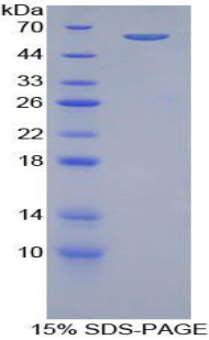 Recombinant Beta Adrenergic Receptor Kinase (BARK)
