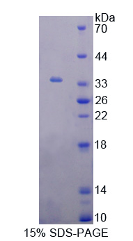 RPC194Hu01.jpg