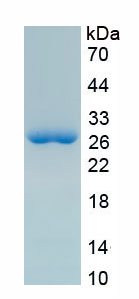 Recombinant Desmoplakin (DSP)