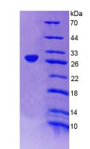Recombinant Amphiphysin (AMPH)