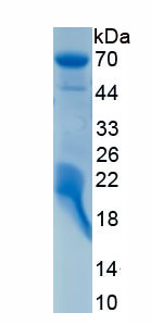 Recombinant Histone Deacetylase 1 (HDAC1)