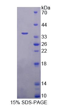 Recombinant Methyl CpG Binding Domain Protein 2 (MBD2)