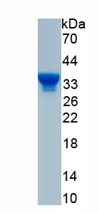 Recombinant Methyl CpG Binding Domain Protein 2 (MBD2)