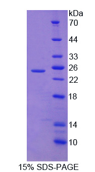 Recombinant Chromodomain Helicase DNA Binding Protein 5 (CHD5)