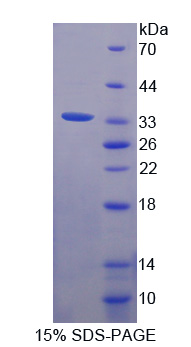 Recombinant Filamin A Alpha (FLNa)