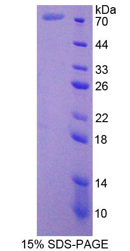 Recombinant Cortactin (CTTN)