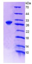 Recombinant Actinin Alpha 1 (ACTN1)